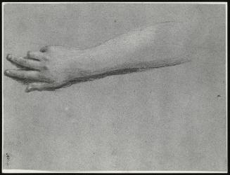 A Lady's Right Hand and Forearm